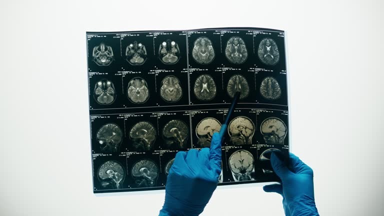 Diagnose Hirntumor